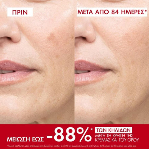 Vichy Liftactiv Pigment Specialist B3 SPF50