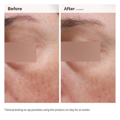 The Ordinary Body Care Niacinamide 5% Face and Body Emulsion