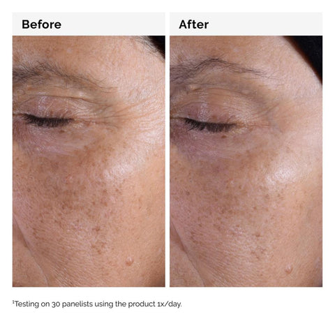 The Ordinary Glycolic Acid 7% Exfoliating Toner