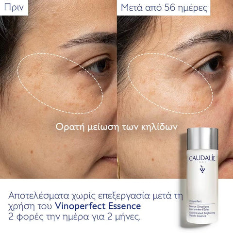 Caudalie Vinoperfect Concentrated Glycolic Essence