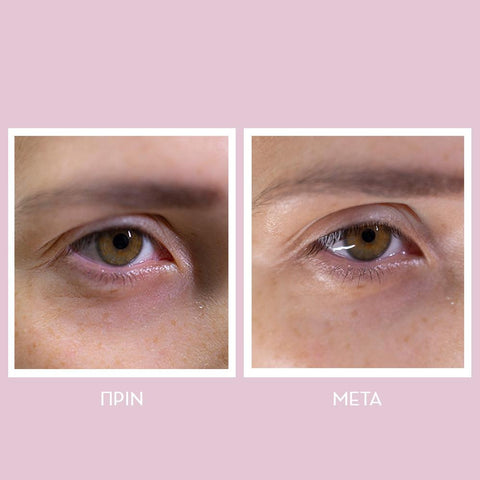 Youth Lab Peptides Spring Hydragel Eye Patches - Monodose