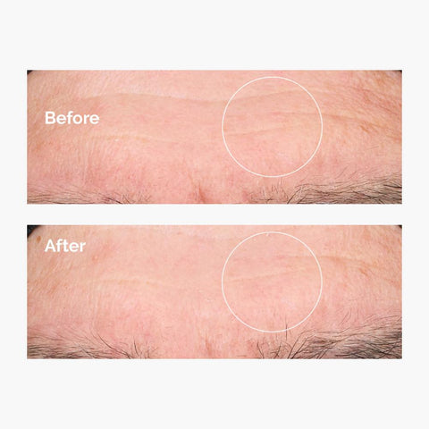 The Ordinary Hyaluronic Acid 2% +B5- Ενυδατικός Ορός