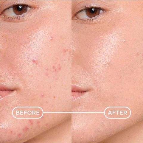 Bioderma Sebium Kerato+ Cover