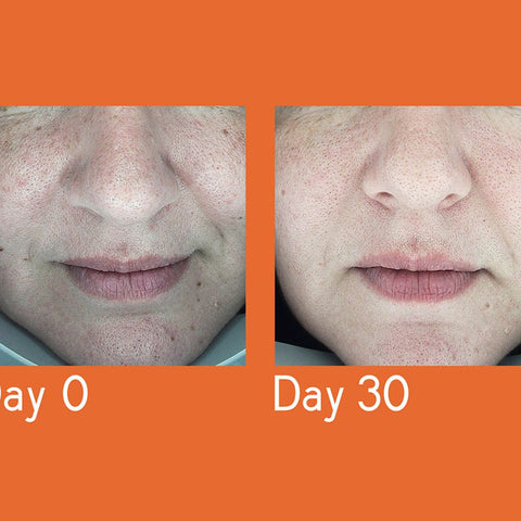 Youth Lab Dark Spot Remover Serum